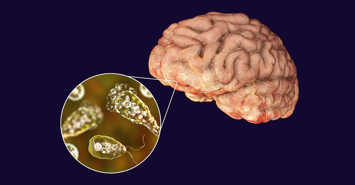 Brain-eating Amoeba