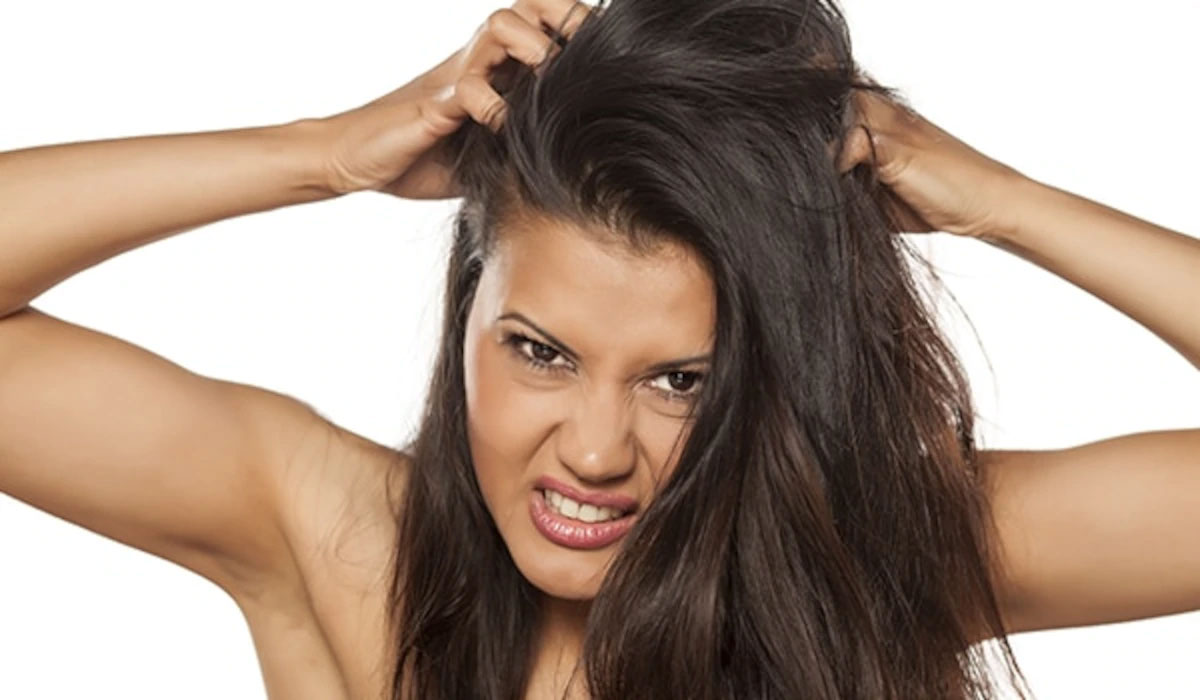 Some home remedies to get rid of dandruff in the hair