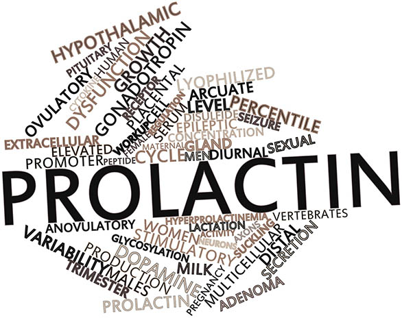 Prolactin is high; May cause infertility. Things to know