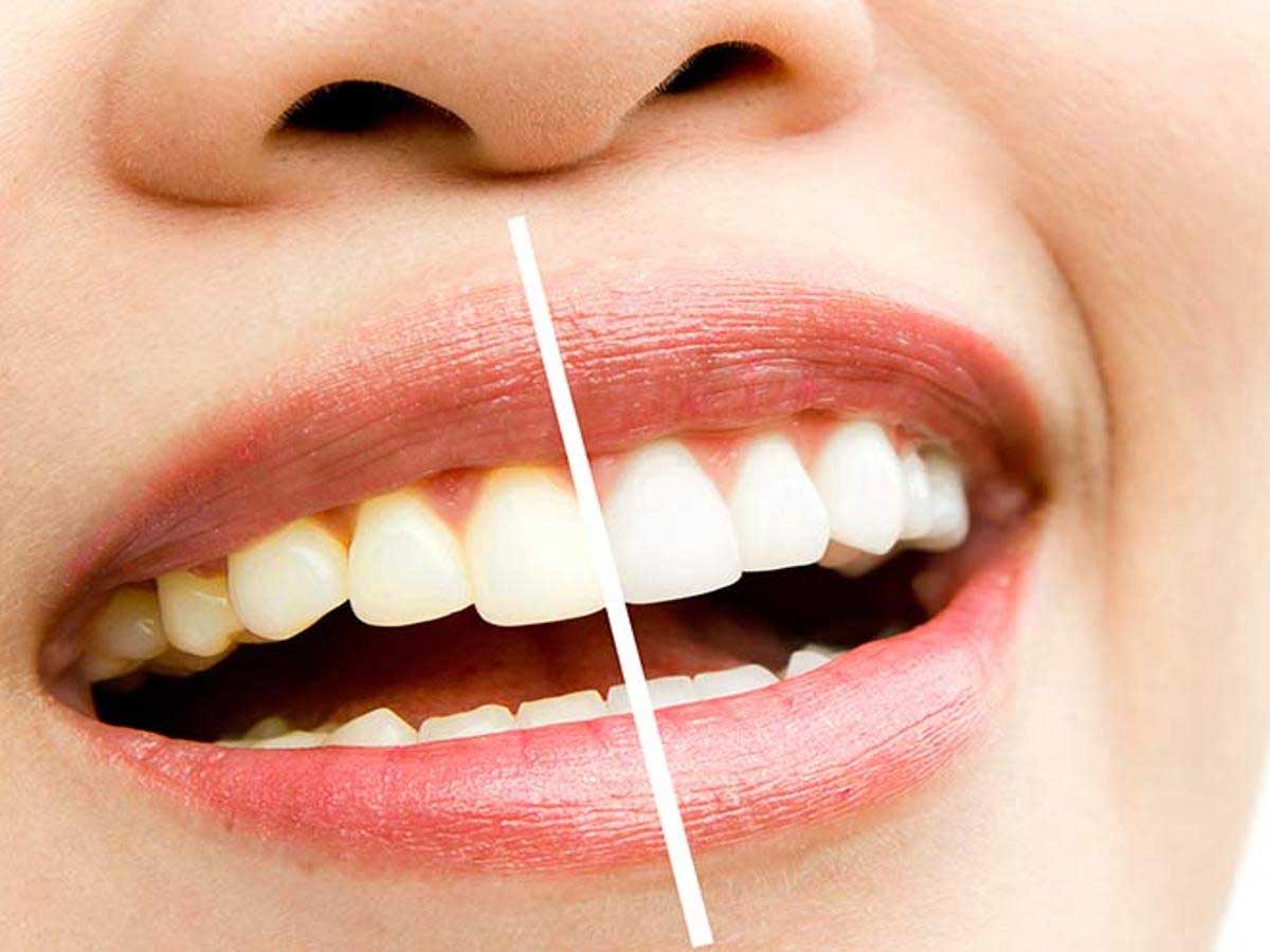 How to keep teeth and tongue hygienic and healthy in Ayurvedic way?