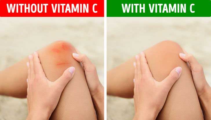 How to recognize vitamin C deficiency in our body