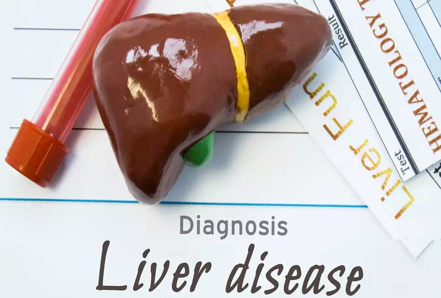Fatty liver can be kept away to some extent by certain drinks