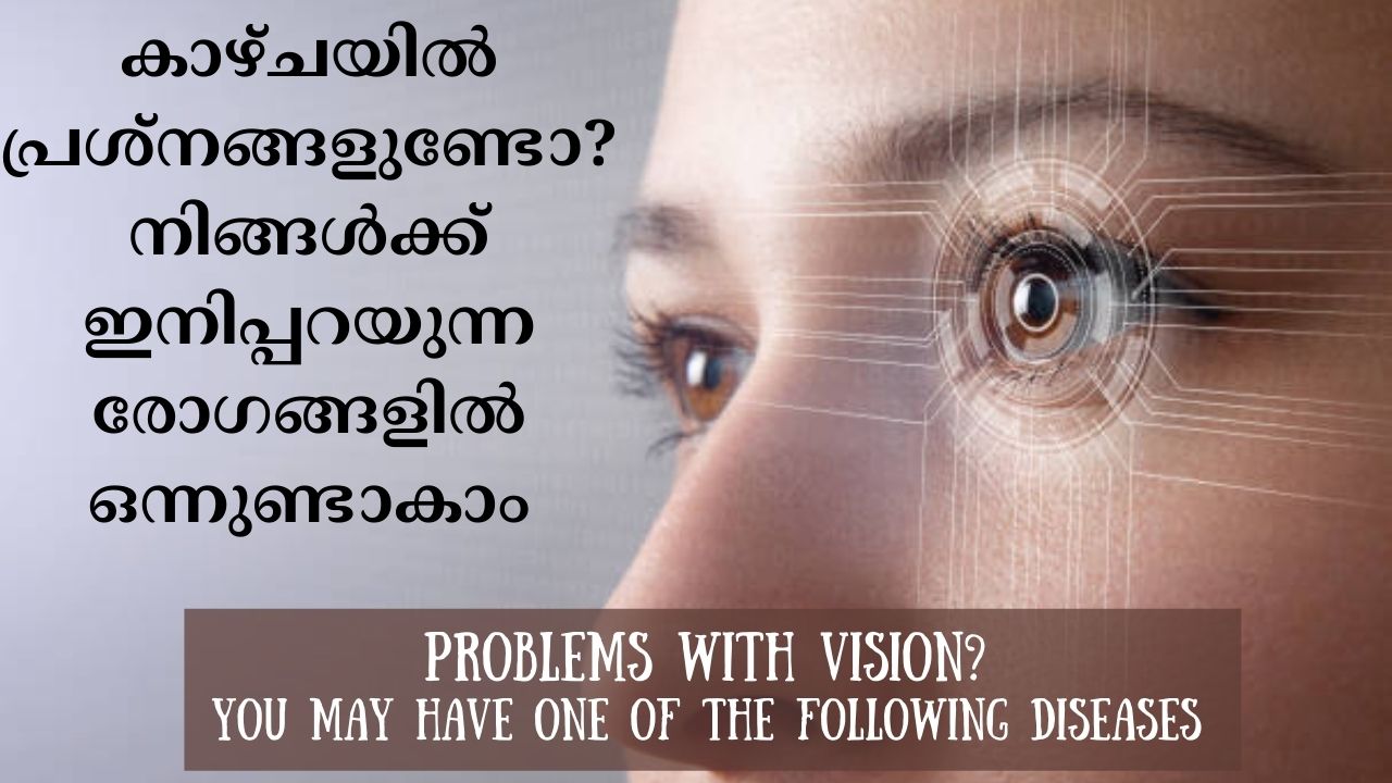 Problems with vision? You may have one of the following diseases