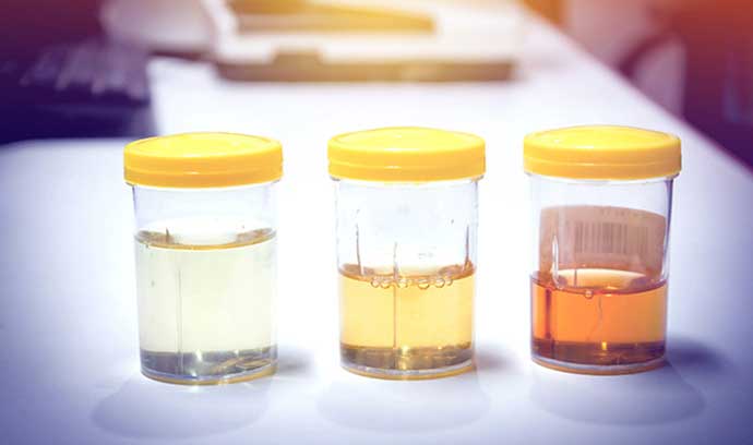 Urine color will say  about your health