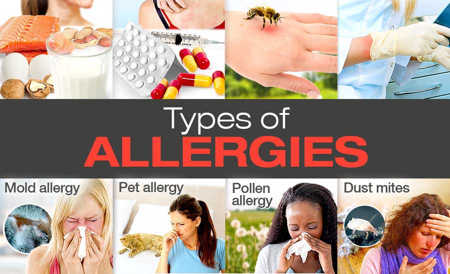 Different types of allergies and their remedies