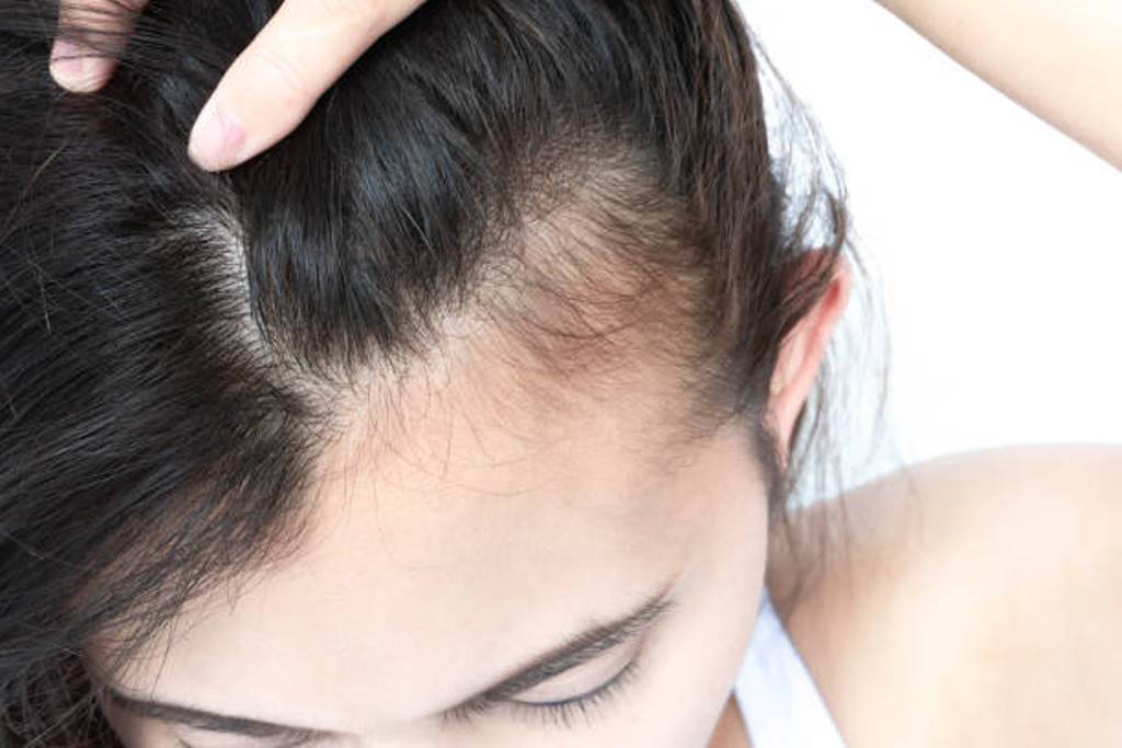 Hair Loss reason and remedies