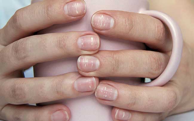 Don't ignore the white spots on the nails
