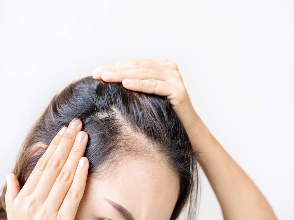 Alopecia areata is a common autoimmune disorder that often results in unpredictable hair loss.