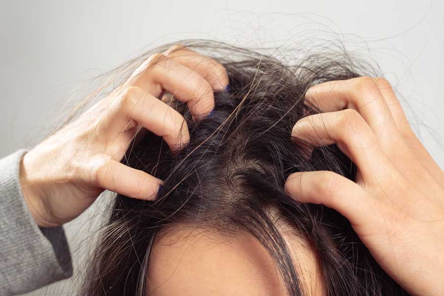 How to get rid of itchy scalp?