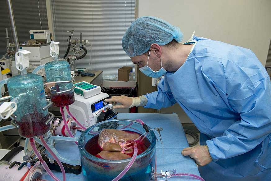 Things you should know before undergoing liver transplantation