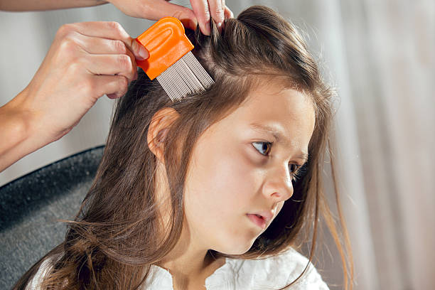 Some easy remedies to get rid of head lice