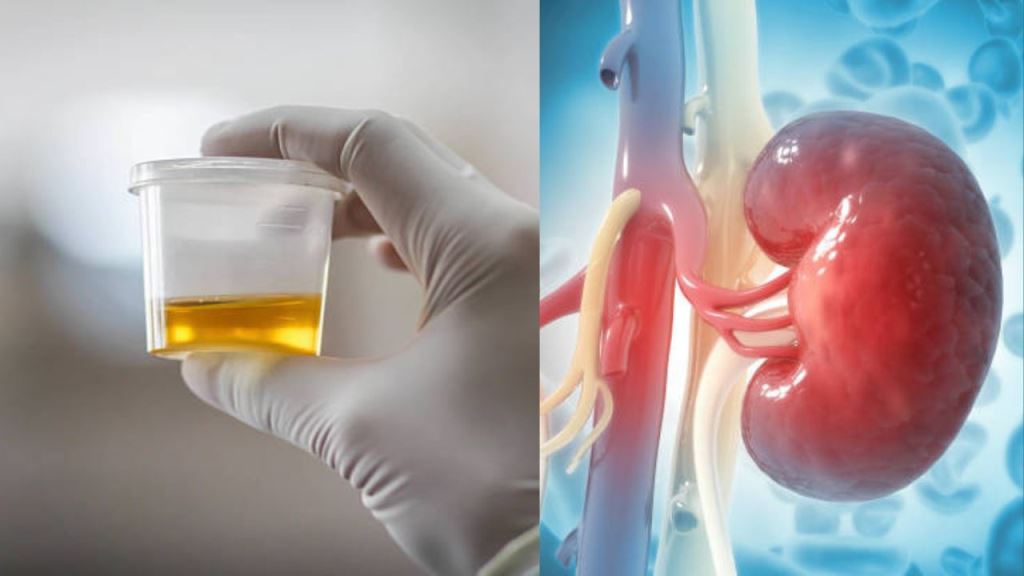 Health can be identified by looking at the color of urine