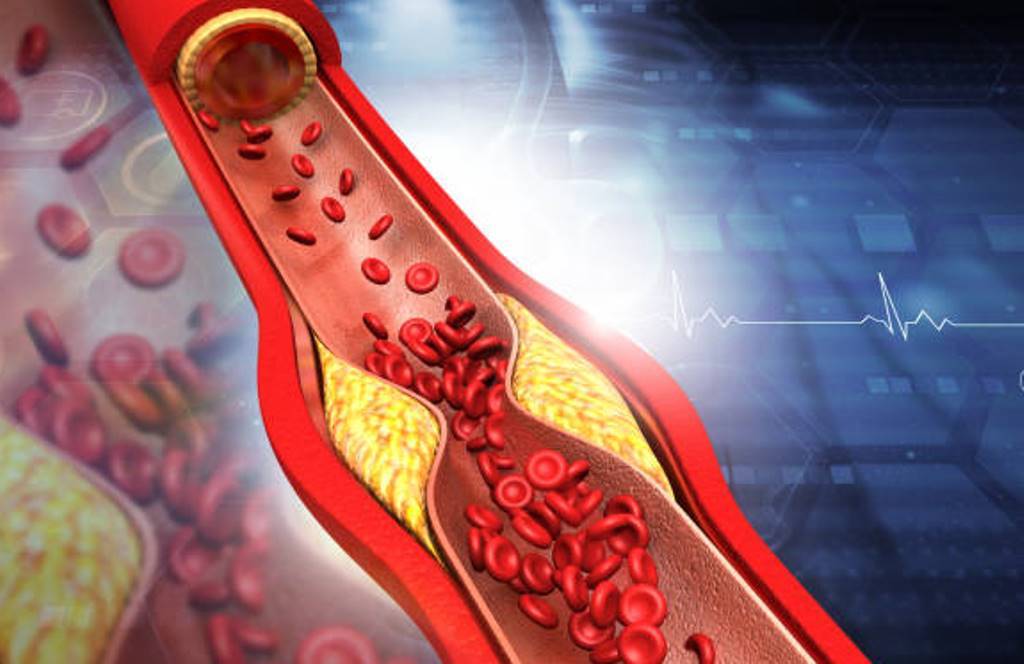 Cholesterol; How to reduce? What to watch out for?