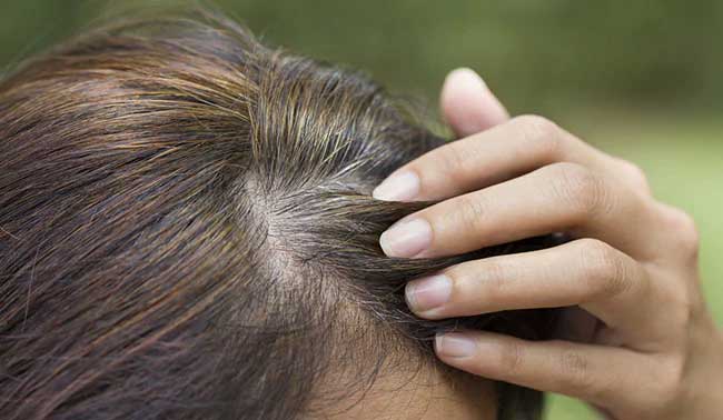 Natural home remedies of Grey hair