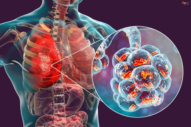 Which are all body organs can be affected by Tuberculosis?