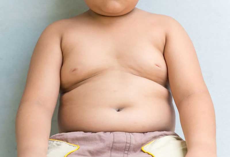 Causes and remedies for obesity in children