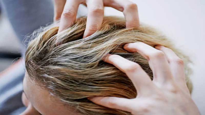 These benefits can be achieved if you apply oil to your hair regularly