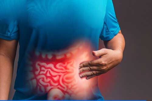 What is Ulcerative Colitis? What are the symptoms?